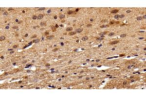 Detection of IBA1 in Rat Cerebrum Tissue using Monoclonal Antibody to Ionized Calcium-binding Adapter Molecule 1 (IBA1)