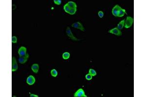 Immunofluorescent analysis of MCF-7 cells using ABIN7171428 at dilution of 1:100 and Alexa Fluor 488-congugated AffiniPure Goat Anti-Rabbit IgG(H+L)