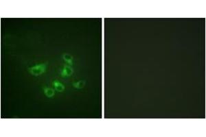Immunofluorescence analysis of HepG2 cells, using Tryptophan Hydroxylase (Ab-58) Antibody. (Tryptophan Hydroxylase 1 antibody  (AA 26-75))