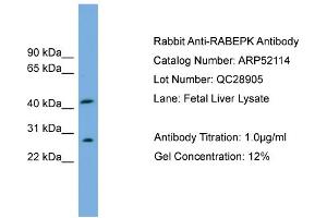 WB Suggested Anti-RABEPK  Antibody Titration: 0. (RABEPK antibody  (N-Term))