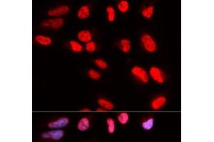 Immunofluorescence analysis of U2OS cells using PRPF3 Polyclonal Antibody (PRPF3 antibody)
