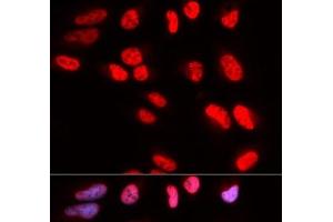 Immunofluorescence analysis of U2OS cells using PRPF3 Polyclonal Antibody (PRPF3 antibody)