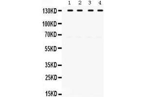 Western Blotting (WB) image for anti-Toll-Like Receptor Adaptor Molecule 1 (TICAM1) (AA 53-84), (N-Term) antibody (ABIN3043539) (TICAM1 antibody  (N-Term))