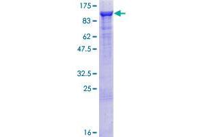 Image no. 1 for rho GTPase Activating Protein 26 (ARHGAP26) (AA 1-759) protein (GST tag) (ABIN1345506) (GRAF Protein (AA 1-759) (GST tag))