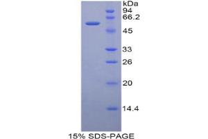 SDS-PAGE analysis of Rat CUZD1 Protein. (CUZD1 Protein)