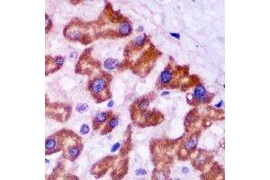 Immunohistochemistry (IHC) image for anti-Peroxisomal Biogenesis Factor 5 (PEX5) antibody (ABIN7308158) (PEX5 antibody)