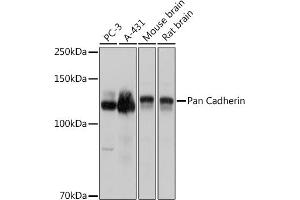 Western blot analysis of extracts of various cell lines, using Pan Cadherin antibody (ABIN7266233) at 1:3000 dilution. (CDH1,CDH2,CDH3,CDH4 (AA 800-882) antibody)