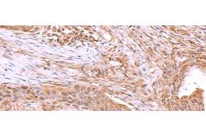 JDP2 antibody