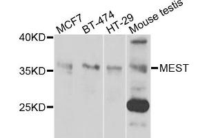 Western blot analysis of extracts of various cells, using MEST antibody. (MEST antibody)