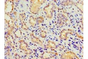 Immunohistochemistry of paraffin-embedded human kidney tissue using ABIN7146745 at dilution of 1:100 (CBR3 antibody  (AA 118-277))