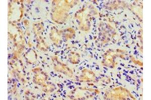 Immunohistochemistry of paraffin-embedded human kidney tissue using ABIN7146745 at dilution of 1:100