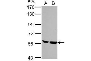 WB Image Sample (30 ug of whole cell lysate) A: NIH-3T3 B: JC 7. (HCLS1 antibody  (C-Term))