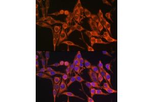 Immunofluorescence analysis of HeLa cells using MT- antibody (ABIN7268594) at dilution of 1:100.