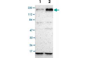 Western Blot analysis of Lane 1: RT-4 and Lane 2: U-251MG sp cell lysates with BRIP1 polyclonal antibody .