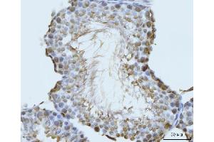 IHC analysis of GHITM using anti-GHITM antibody (ABIN7599294). (GHITM antibody  (AA 1-345))