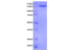 Recombinant MMSET / WHSC1 protein gel. (WHSC1 Protein (DYKDDDDK Tag))
