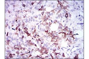 Immunohistochemistry (IHC) image for anti-Secreted phosphoprotein 1 (SPP1) (AA 167-314) antibody (ABIN1845756) (Osteopontin antibody  (AA 167-314))