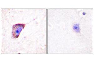 Immunohistochemistry (IHC) image for anti-Tyrosine Hydroxylase (TH) (pSer19) antibody (ABIN1847228) (Tyrosine Hydroxylase antibody  (pSer19))