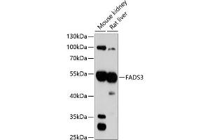 Western blot analysis of extracts of various cell lines, using F antibody (ABIN1679802, ABIN3018325, ABIN3018326 and ABIN6220437) at 1:3000 dilution. (FADS3 antibody  (AA 1-130))