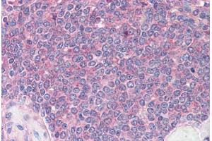 Spleen: Formalin-Fixed, Paraffin-Embedded (FFPE) (DDX3X antibody  (Internal Region))