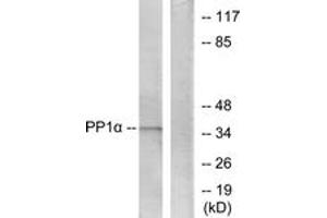 Western Blotting (WB) image for anti-Protein Phosphatase 1, Catalytic Subunit, alpha Isoform (PPP1CA) (AA 281-330) antibody (ABIN2888749) (PPP1CA antibody  (AA 281-330))