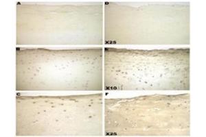 Sections of cartilage, showing immnostaining for galectin-3 from normal (A-C) and osteoarthritic cartilage (D-F). (Galectin 3 antibody  (N-Term))