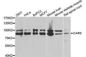 Western blot analysis of extracts of various cell lines, using CARS antibody. (CARS antibody)
