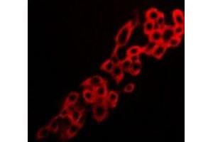 Immunofluorescent analysis of Adenosine A2a Receptor staining in LOVO cells. (Adenosine A2a Receptor antibody  (C-Term))