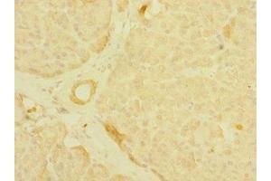 Immunohistochemistry of paraffin-embedded human pancreatic tissue using ABIN7158910 at dilution of 1:100 (MPP6 antibody  (AA 220-420))