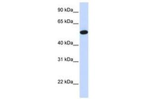 Image no. 1 for anti-Carcinoembryonic Antigen-Related Cell Adhesion Molecule 16 (CEACAM16) (AA 337-386) antibody (ABIN6740912) (CEACAM16 antibody  (AA 337-386))
