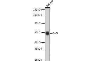 Western blot analysis of extracts of Rat eye cells, using SAG antibody (ABIN6132558, ABIN6147361, ABIN6147362 and ABIN6216887) at 1:1000 dilution. (SAG antibody  (AA 1-405))