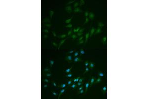 Immunofluorescence analysis of MCF7 cell using LIG1 antibody. (LIG1 antibody)