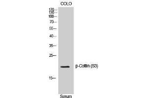 Western Blotting (WB) image for anti-Cofilin 1 (CFL1) (pSer3) antibody (ABIN3181969) (Cofilin antibody  (pSer3))