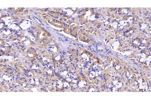 Detection of PDLIM1 in Human Stomach Tissue using Polyclonal Antibody to PDZ And LIM Domain Protein 1 (PDLIM1) (PDLIM1 antibody  (AA 2-329))