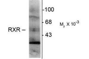 Image no. 1 for anti-Retinoid X Receptor, gamma (RXRG) antibody (ABIN303926) (Retinoid X Receptor gamma antibody)