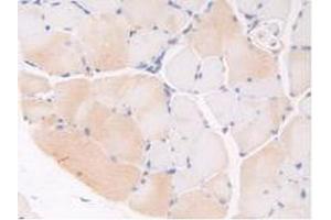 IHC-P analysis of Mouse Skeletal Muscle Tissue, with DAB staining. (Thrombospondin 1 antibody  (AA 515-671))