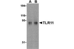 Western blot analysis of TLR11 in RAW264. (TLR11 antibody  (C-Term))
