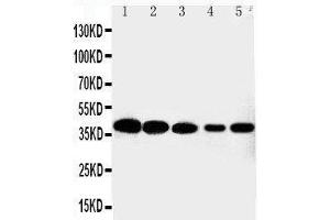 Anti-Cdk7 antibody,  Western blotting Lane 1: HELA Cell Lysate Lane 2: MCF-7 Cell Lysate Lane 3: A549 Cell Lysate Lane 4: COLO320 Cell Lysate Lane 5: JURKAT Cell Lysate (CDK7 antibody  (C-Term))