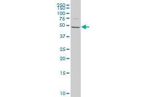 RAD9B polyclonal antibody (A01), Lot # 050919JC01 Western Blot analysis of RAD9B expression in HL-60 . (RAD9B antibody  (AA 150-258))