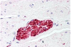 Human Prostate, Nerve (formalin-fixed, paraffin-embedded) stained with S100 Protein antibody ABIN214427 at 2. (S100 Protein (S100) antibody)