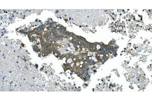 IHC analysis of CDC123 using anti-CDC123 antibody (ABIN7599284). (CDC123 antibody  (AA 1-336))