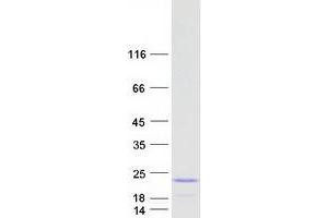 Validation with Western Blot