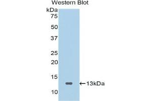 Detection of Recombinant SFRP4, Human using Polyclonal Antibody to Secreted Frizzled Related Protein 4 (SFRP4) (SFRP4 antibody  (AA 265-346))