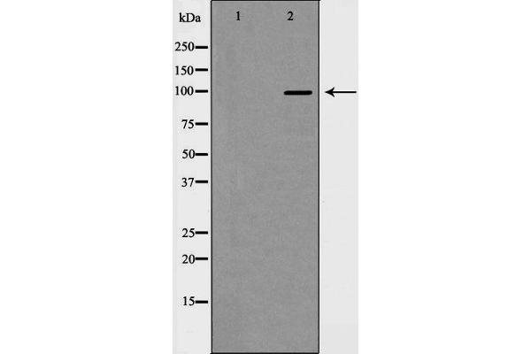 HDAC7 antibody  (C-Term)