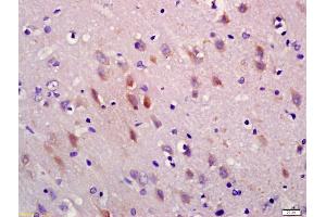 Formalin-fixed and paraffin embedded rat brain labeled with Anti-5HT3A Receptor/SR-3A Polyclonal Antibody, Unconjugated (ABIN1386182) at 1:200 followed by conjugation to the secondary antibody and DAB staining (Serotonin Receptor 3A antibody  (AA 31-130))