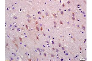 Formalin-fixed and paraffin embedded rat brain labeled with Anti-5HT3A Receptor/SR-3A Polyclonal Antibody, Unconjugated (ABIN1386182) at 1:200 followed by conjugation to the secondary antibody and DAB staining