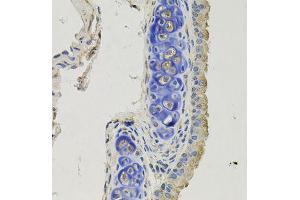 Immunohistochemistry of paraffin-embedded mouse lung using GPHN antibody (ABIN5996450) at dilution of 1/100 (40x lens). (Gephyrin antibody)