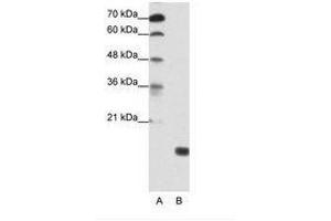 Image no. 1 for anti-TGFB-Induced Factor Homeobox 2-Like, Y-Linked (TGIF2LY) (AA 99-148) antibody (ABIN203023) (TGIF2LY antibody  (AA 99-148))