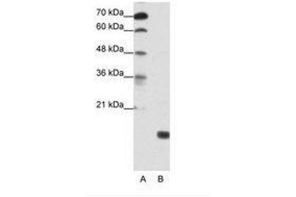 TGIF2LY Antikörper  (AA 99-148)