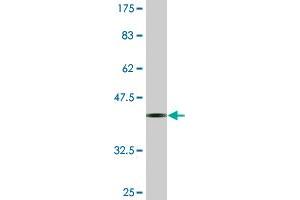 Western Blot detection against Immunogen (37. (TRIM17 / RNF16 antibody  (AA 75-184))